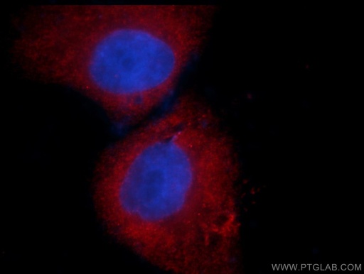 [66021-1-IG-150UL] CDC6 Monoclonal antibody
