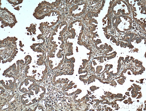 [66030-1-IG-150UL] Protein C inhibitor Monoclonal antibody