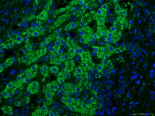 [66032-1-IG-150UL] IVD Monoclonal antibody