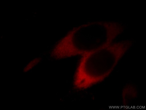 [66036-1-IG-20UL] ASS1 Monoclonal antibody