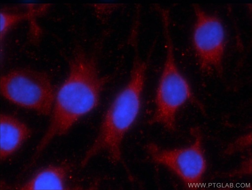 [66043-1-IG-20UL] LONP1 Monoclonal antibody