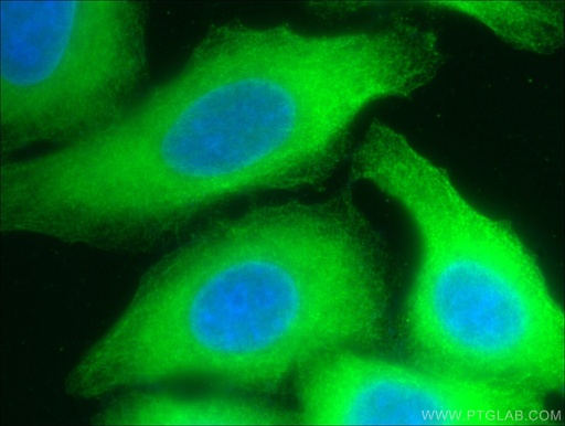 [66046-1-IG-20UL] RPS3 Monoclonal antibody