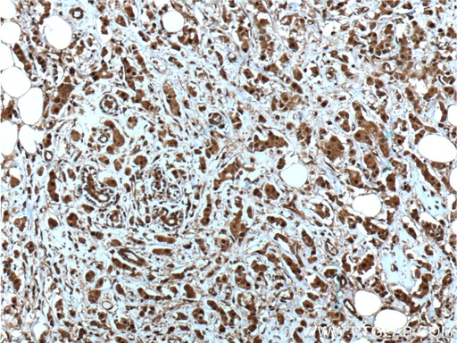 [66048-1-IG-20UL] NOB1 Monoclonal antibody