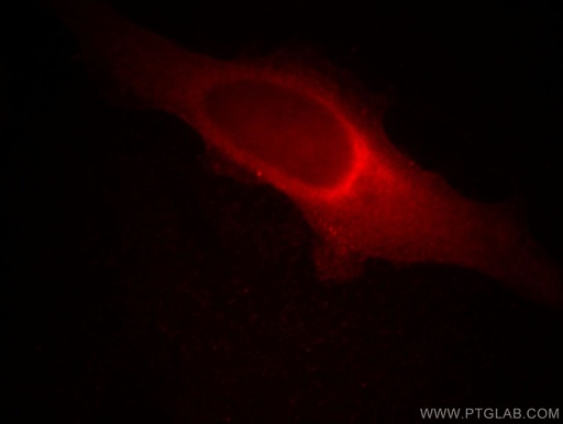 [66049-1-IG-150UL] MMS19 Monoclonal antibody