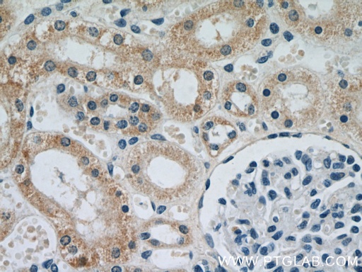 [66053-1-IG-150UL] NDUFS5 Monoclonal antibody