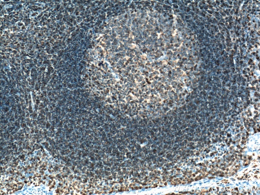 [66054-1-IG-150UL] ARHGDIB Monoclonal antibody