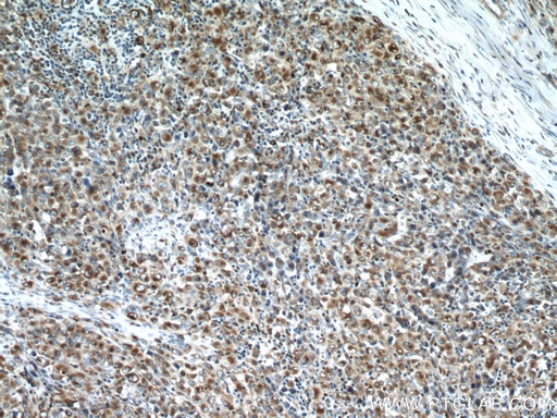 [66058-1-IG-20UL] RAB27A Monoclonal antibody