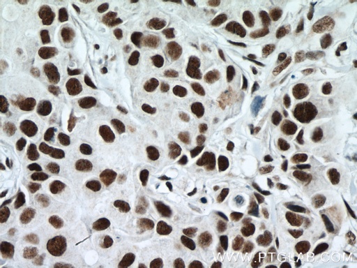 [66059-1-IG-150UL] RBM15 Monoclonal antibody