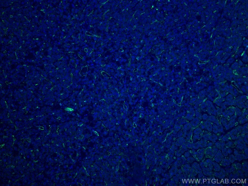 [66065-2-IG-150UL] CD31 Monoclonal antibody
