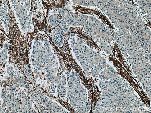 [66067-1-IG-20UL] Caveolin-1 Monoclonal antibody