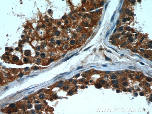 [66072-1-IG-20UL] CPT1C Monoclonal antibody
