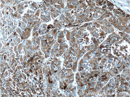[66074-1-IG-20UL] Apolipoprotein H Monoclonal antibody
