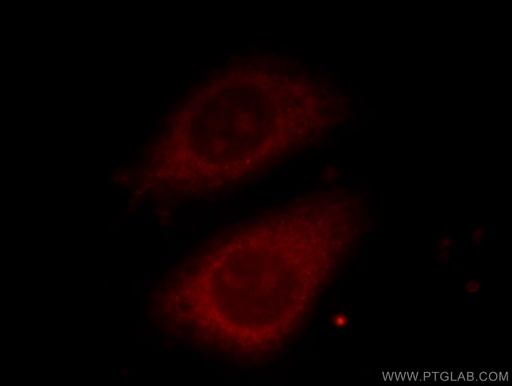 [66077-1-IG-150UL] TELO2 Monoclonal antibody