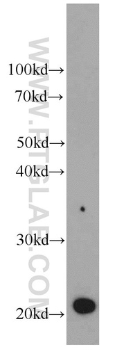 [66080-1-IG-150UL] GM2A Monoclonal antibody