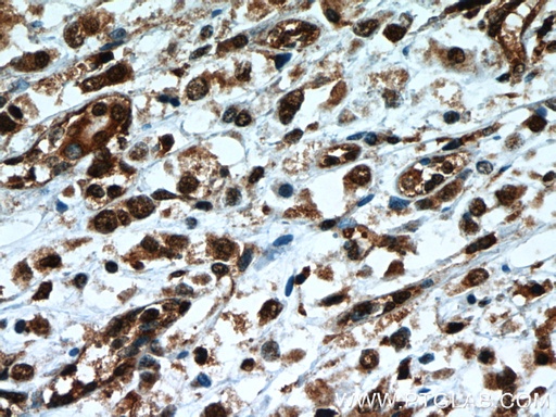 [66083-1-IG-20UL] TLE3 Monoclonal antibody