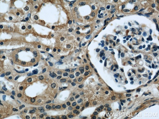 [66084-1-IG-150UL] Serum amyloid P component Monoclonal antibody
