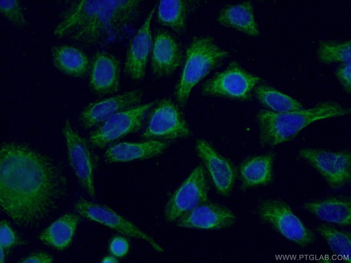 [66088-1-IG-20UL] NCALD Monoclonal antibody