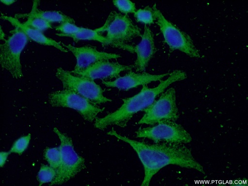 [66089-1-IG-20UL] Factor XII Monoclonal antibody