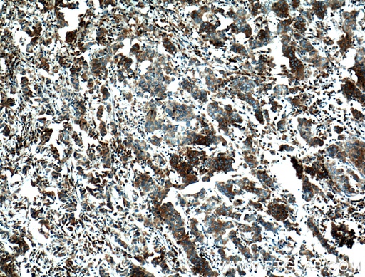 [66091-1-IG-150UL] FKBP2 Monoclonal antibody