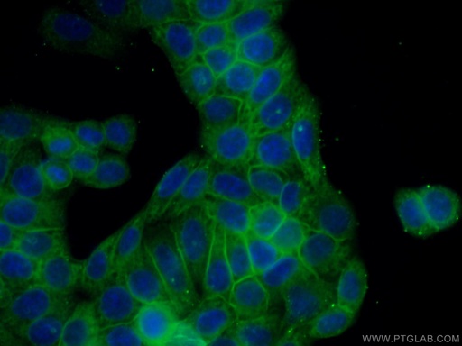 [66093-1-IG-150UL] Caspase 8/p43/p18 Monoclonal antibody
