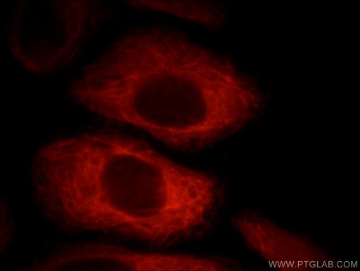 [66096-1-IG-150UL] Villin Monoclonal antibody