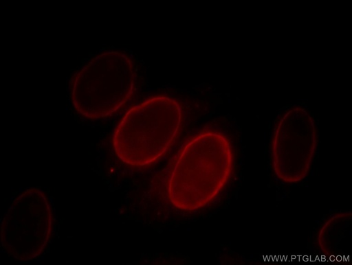 [66098-1-IG-150UL] S100A6 Monoclonal antibody