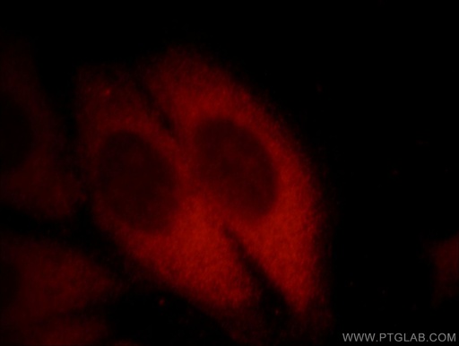 [66099-1-IG-150UL] EXOSC2 Monoclonal antibody