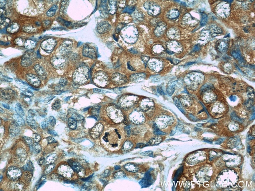 [66100-1-IG-20UL] PDCD4 Monoclonal antibody