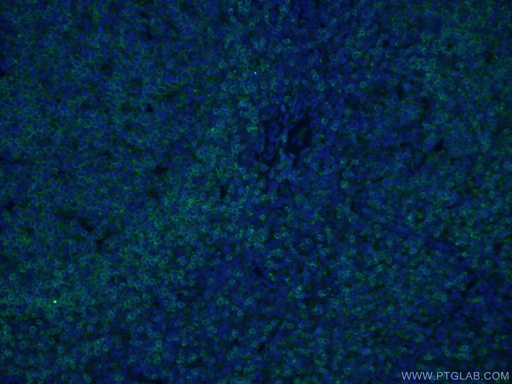 [66103-1-IG-20UL] CD22 Monoclonal antibody