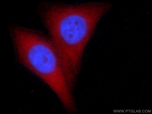 [66105-1-IG-20UL] PGM1 Monoclonal antibody