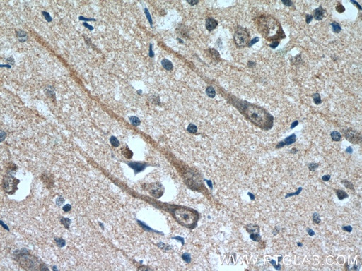 [66107-1-IG-20UL] MAOB Monoclonal antibody