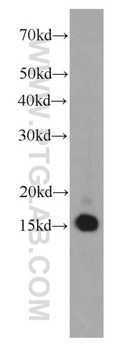 [66111-1-IG-20UL] SNRPD2 Monoclonal antibody
