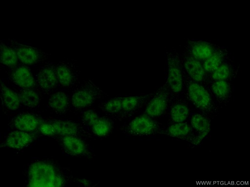 [66114-1-IG-150UL] TFIP11 Monoclonal antibody