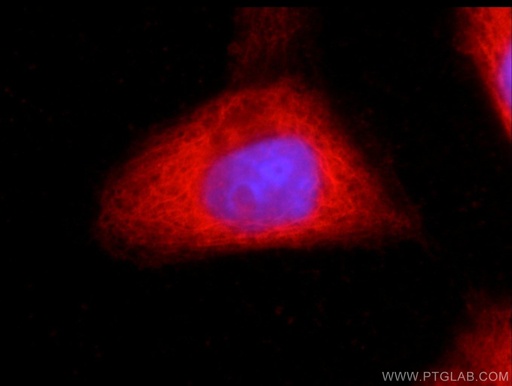 [66115-1-IG-150UL] CSK Monoclonal antibody