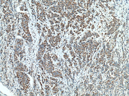 [66117-1-IG-20UL] ECHS1 Monoclonal antibody