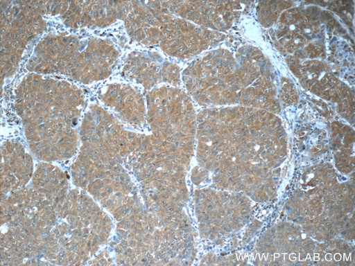 [66118-1-IG-20UL] FUT8 Monoclonal antibody