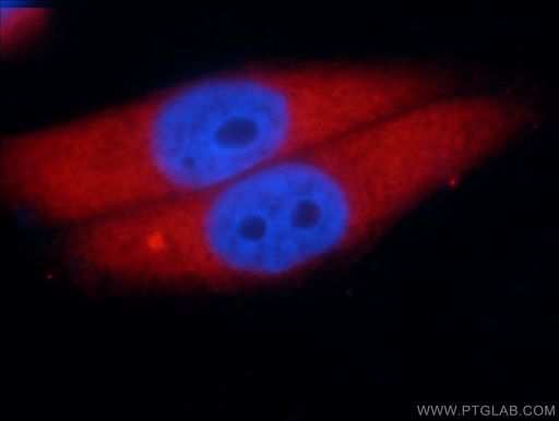 [66120-1-IG-20UL] Aldolase C Monoclonal antibody