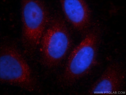 [66121-1-IG-150UL] Alpha Galactosidase A Monoclonal antibody