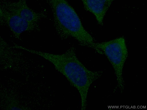 [66123-1-IG-150UL] Kininogen 1 Monoclonal antibody