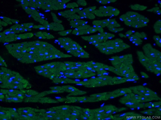 [66125-1-IG-150UL] ACTC1-specific Monoclonal antibody