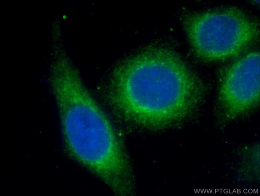 [66126-1-IG-150UL] Alpha-2-Macroglobulin Monoclonal antibody