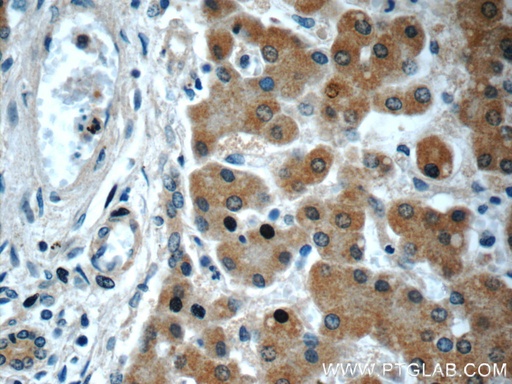 [66134-1-IG-150UL] GOSR2/Membrin Monoclonal antibody
