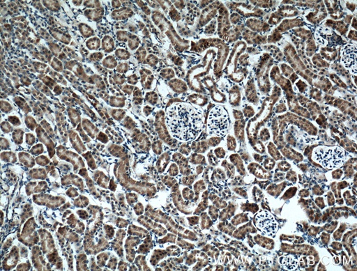 [66136-1-IG-150UL] BBS5 Monoclonal antibody