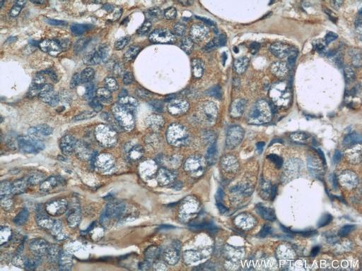 [66138-1-IG-20UL] TRPC4AP Monoclonal antibody