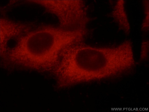 [66140-1-IG-150UL] C9orf72 Monoclonal antibody
