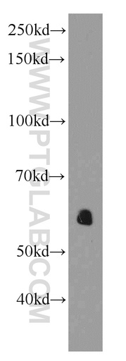 [66141-1-IG-150UL] AEBP2 Monoclonal antibody