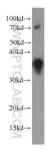 [66145-1-IG-20UL] IL-16 Monoclonal antibody