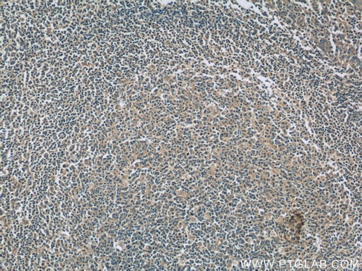 [66146-1-IG-150UL] IL-6 Monoclonal antibody