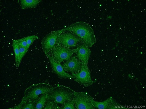[66150-1-IG-20UL] NSE Monoclonal antibody