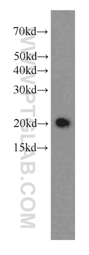 [66152-1-IG-150UL] STMN3 Monoclonal antibody